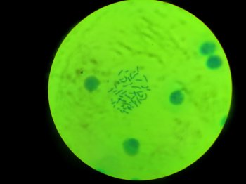 Chromosomy bez tajemnic